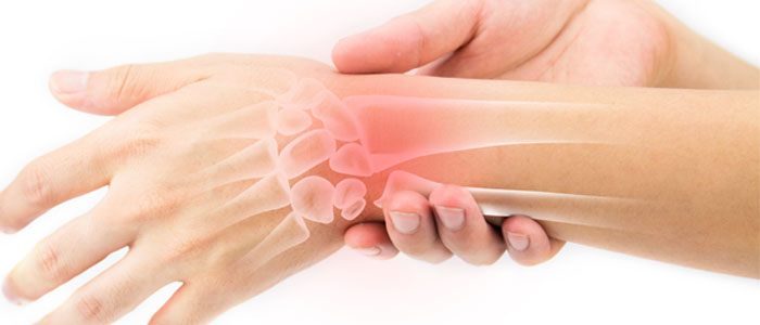Arthritis Treatment Advanced Spine & Sport Chiropractic